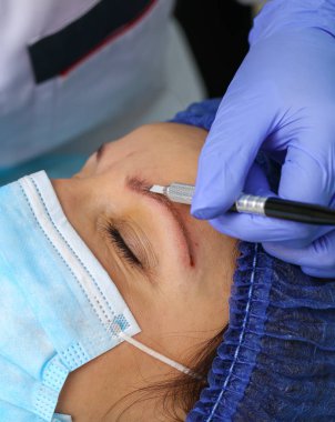 Microblasting eski makyaj kaldırmak.