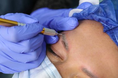 Microblasting eski makyaj kaldırmak.