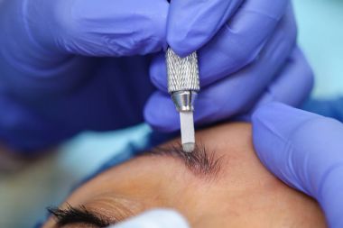 Microblasting eski makyaj kaldırmak.