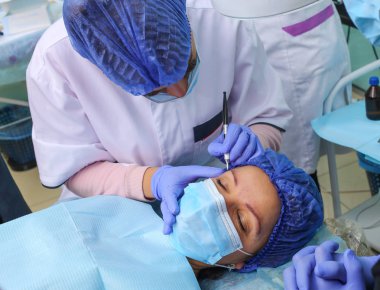 Microblasting eski makyaj kaldırmak.