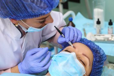 Microblasting eski makyaj kaldırmak.