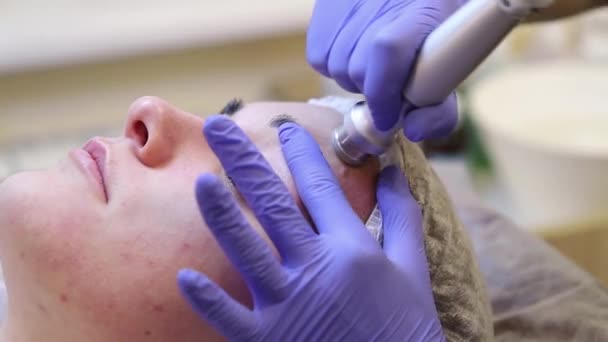 Tillvägagångssättet av Microdermabrasion. — Stockvideo