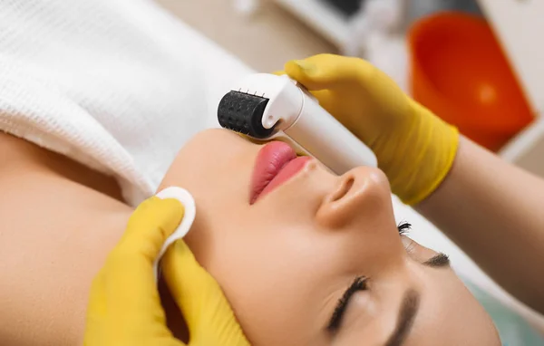 Mesotherapy microneedle,  mesoroller. — 스톡 사진