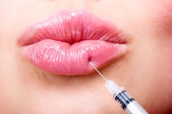 Primer plano de la hermosa mujer joven que recibe la inyección de relleno en los labios, concepto de tratamiento de belleza —  Fotos de Stock