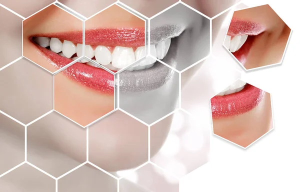 Picture Woman Smile Abstract Background Blurred Lights Dental Care Concept — Stock Photo, Image