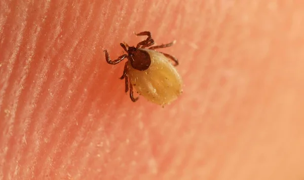 Tick on skin — Stock Photo, Image