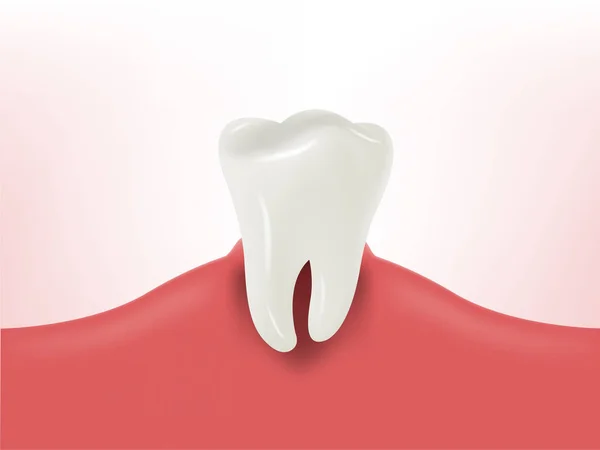 Красивая иллюстрация реалистичного зуба на десне, концепция стоматологического здоровья, гнилой зуб — стоковый вектор