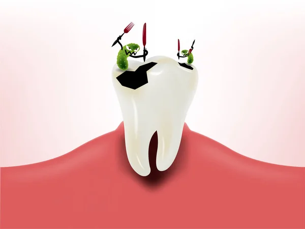 Design gráfico de bactérias comendo dente na gengiva, conceito de design de saúde dental, dente cariado — Vetor de Stock