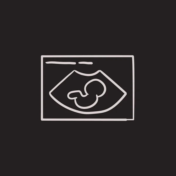 Ícone de esboço de ultra-som fetal . —  Vetores de Stock