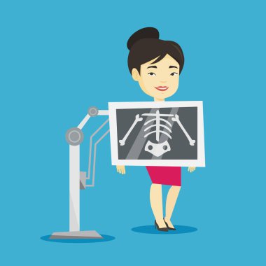 Hasta x ışını yordamı vektör çizim sırasında