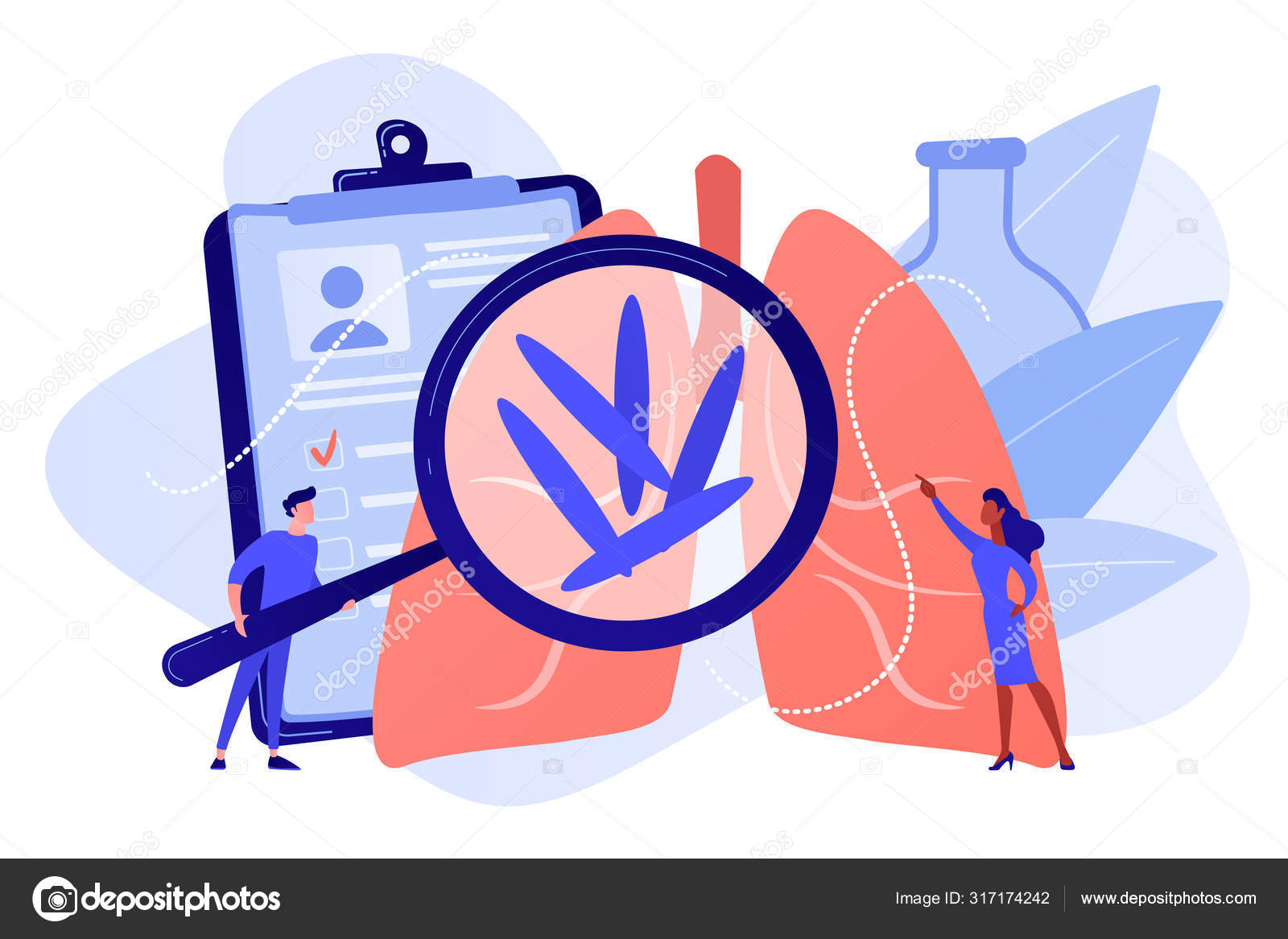 Tuberculose conceito vetor ilustração . Vetor de ©VisualGeneration 317174242, image size:1600x1167