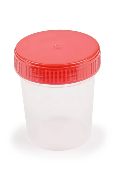 Urine sample in container. — Stock Photo, Image
