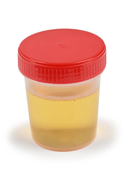 Urine sample in container. — Stock Photo, Image