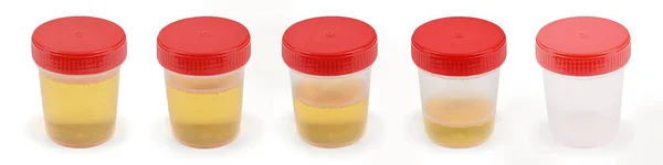 Fem Urinprov Behållare Högupplöst Foto Med Klippväg Fullständigt Skärpedjup — Stockfoto