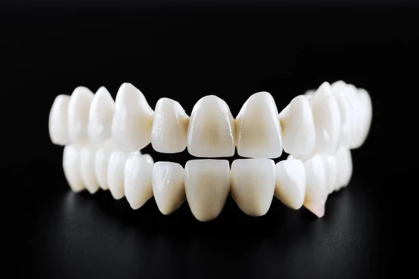 黑色背景下隔离的白色陶瓷牙 — 图库照片
