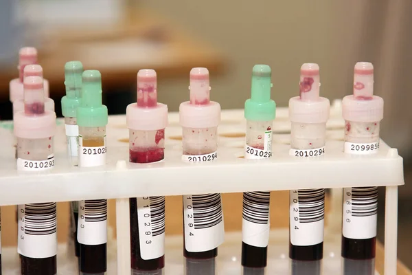 Ampoules Blood Tests Table Doctor Office — Stock Photo, Image