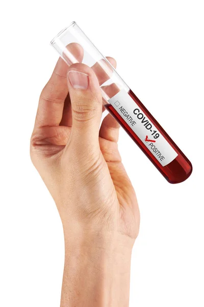 考文19号血样样本于手上的试管内 在白血球上分离 — 图库照片