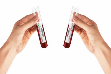 Coronavirus Covid 19 kan örneği elinde numune tüpünde, beyaz üzerinde izole.