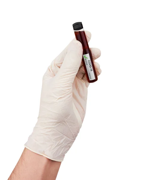 Coronavirus Covid Amostra Sangue Tubo Amostra Mão Isolado Branco — Fotografia de Stock