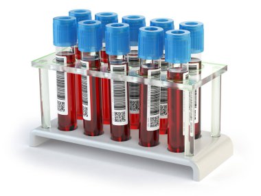 Beyaz arka plan üzerinde izole tüpler kan testi örnekleri