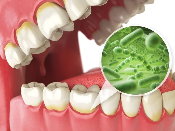 Bacterias y virus alrededor de los dientes. Conce médica de higiene dental —  Fotos de Stock