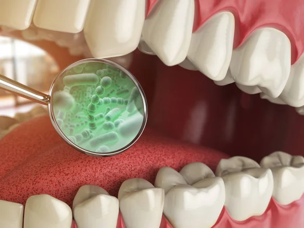 Bakterilerin ve virüs diş çevresinde. Dişlerle ilgili sağlık bilgisi tıbbi conce — Stok fotoğraf