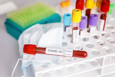 COVID-19 test tüpü ve yeni Corona virüsü enfeksiyonu (hastane geçmişinden gelen Corona virüsü hastalığı) tanısı için laboratuvar kan testi örneği. Bulaşıcı salgın konsepti