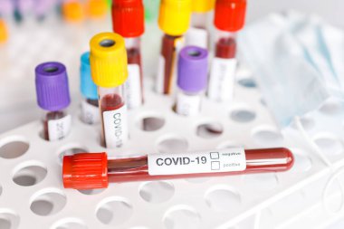 COVID-19 test tüpü ve yeni Corona virüsü enfeksiyonu (hastane geçmişinden gelen Corona virüsü hastalığı) tanısı için laboratuvar kan testi örneği. Bulaşıcı salgın konsepti