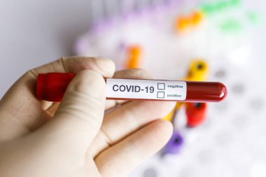 COVID-19 test tüpü ve yeni Corona virüsü enfeksiyonu (hastane geçmişinden gelen Corona virüsü hastalığı) tanısı için laboratuvar kan testi örneği. Bulaşıcı salgın konsepti
