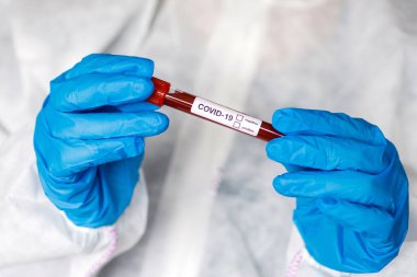 COVID-19 test tüpü ve yeni Corona virüsü enfeksiyonu (hastane geçmişinden gelen Corona virüsü hastalığı) tanısı için laboratuvar kan testi örneği. Bulaşıcı salgın konsepti