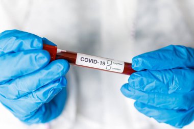 Covid 19 Coronavirus, Coronavirus araştırma laboratuarındaki bilim adamı doktor biyolojik tehlike koruma giysileri elinde bulunan tüpteki kanı enfekte etti. Coronavirus Covid-19 aşı araştırması.