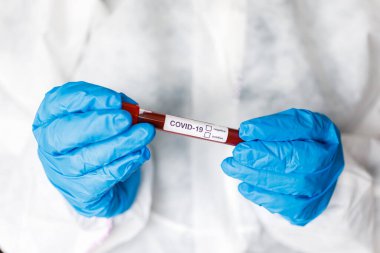 Covid 19 Coronavirus, Coronavirus araştırma laboratuarındaki bilim adamı doktor biyolojik tehlike koruma giysileri elinde bulunan tüpteki kanı enfekte etti. Coronavirus Covid-19 aşı araştırması.
