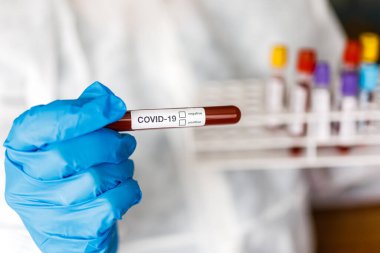 Covid 19 Coronavirus, Coronavirus araştırma laboratuarındaki bilim adamı doktor biyolojik tehlike koruma giysileri elinde bulunan tüpteki kanı enfekte etti. Coronavirus Covid-19 aşı araştırması.