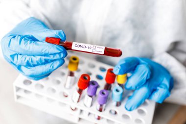 Covid 19 Coronavirus, Coronavirus araştırma laboratuarındaki bilim adamı doktor biyolojik tehlike koruma giysileri elinde bulunan tüpteki kanı enfekte etti. Coronavirus Covid-19 aşı araştırması.