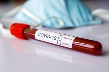 Coronavirus 2019 nCoV pozitif ya da negatif kan testi. Sonuca odaklan.