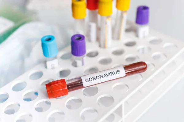 Covid Test Tube Laboratory Sample Blood Testing Diagnosis New Corona — Stock Photo, Image