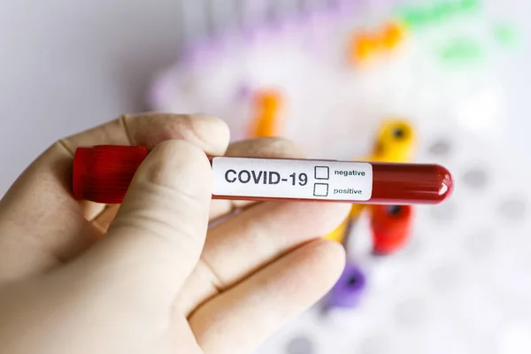 Covid Test Tube Laboratory Sample Blood Testing Diagnosis New Corona — Stock Photo, Image