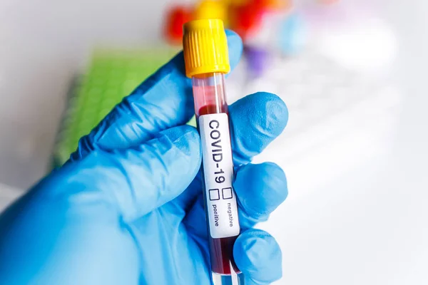 Tubo Teste Covid Amostra Laboratório Exames Sangue Para Diagnóstico Nova — Fotografia de Stock