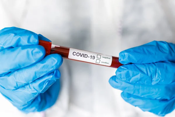Covid Sangre Infectada Con Coronavirus Tubo Mano Del Médico Científico —  Fotos de Stock