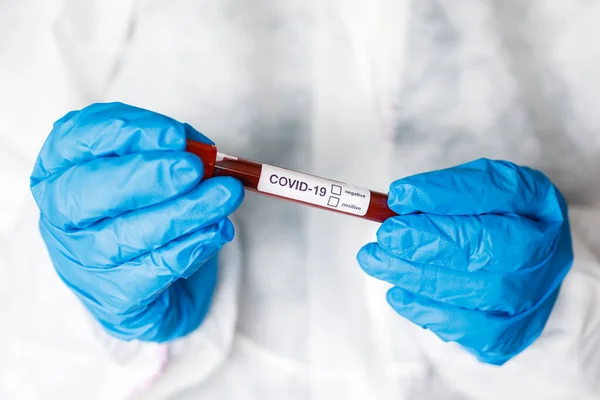 Covid Coronavirus Infected Blood Tube Hand Scientist Doctor Biohazard Protection — Stock Photo, Image