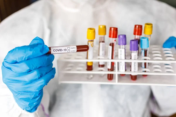 Covid Coronavirus Μολυσμένο Αίμα Στο Σωλήνα Στο Χέρι Του Επιστήμονα — Φωτογραφία Αρχείου