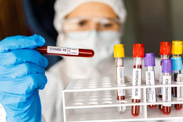 Covid Coronavirus Infectou Sangue Tubo Mão Cientista Roupas Proteção Risco — Fotografia de Stock