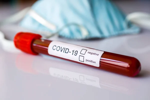 Coronavirus 2019 Ncov Θετική Αρνητική Εξέταση Αίματος Εστίαση Στο Αποτέλεσμα — Φωτογραφία Αρχείου