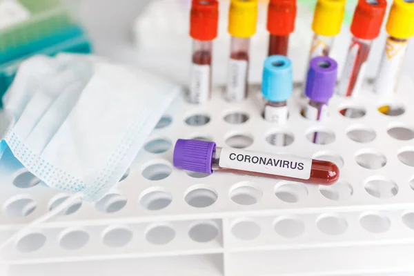 Covid Kémcső Laboratóriumi Minta Vérvizsgálattal Diagnosztizálásra Corona Vírus Fertőzés Corona Stock Kép
