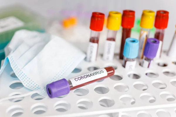 Tubo Teste Covid Amostra Laboratório Exames Sangue Para Diagnóstico Nova Fotos De Bancos De Imagens Sem Royalties