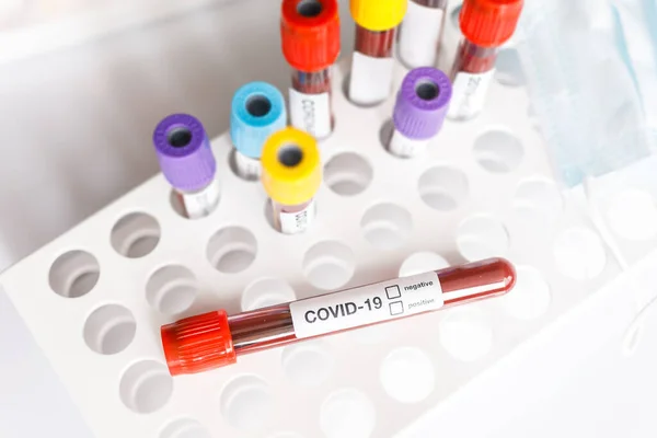 Covid Test Tube Laboratory Sample Blood Testing Diagnosis New Corona Stock Photo