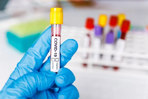 Tubo Teste Covid Amostra Laboratório Exames Sangue Para Diagnóstico Nova Fotos De Bancos De Imagens