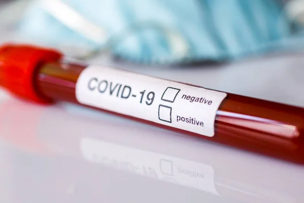 Coronavirus 2019 Ncov Positiv Oder Negativ Bluttest Ergebnisorientierung lizenzfreie Stockfotos