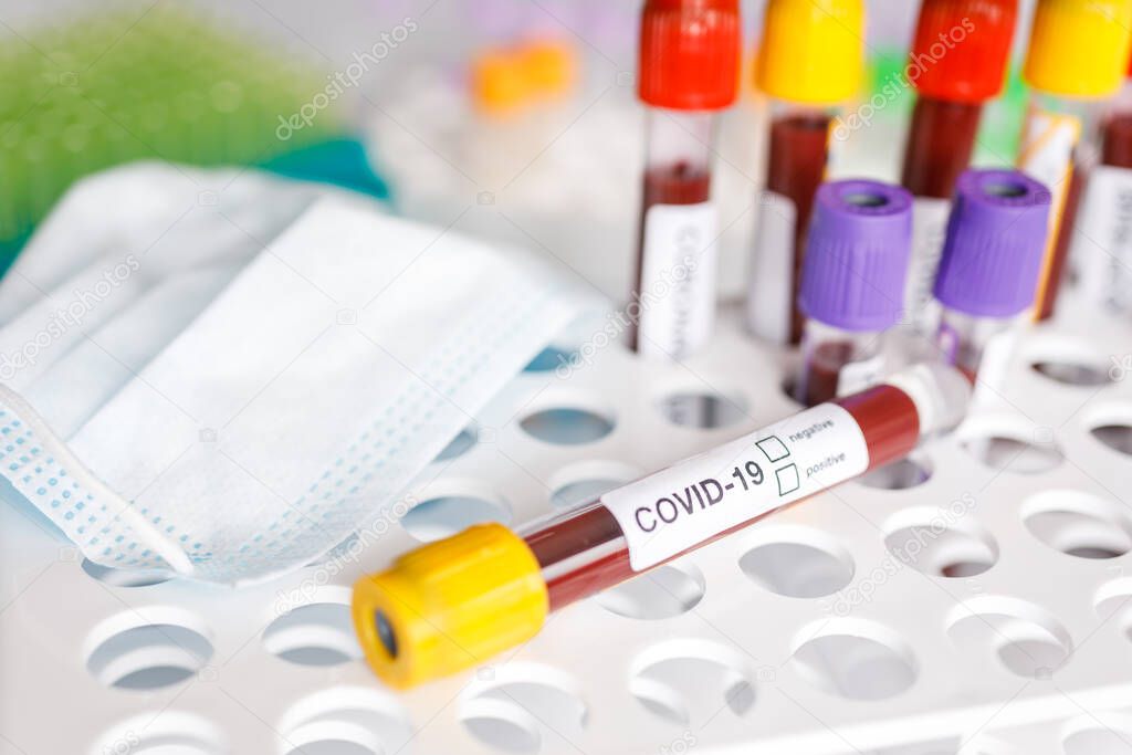 COVID-19 test tube and laboratory sample of blood testing for diagnosis new Corona virus infection(novel corona virus disease from hospital background. Pandemic infectious concept