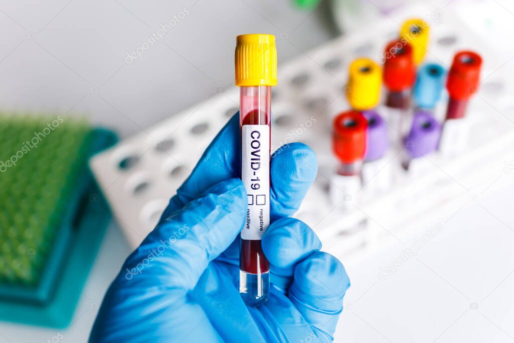 COVID-19 test tube and laboratory sample of blood testing for diagnosis new Corona virus infection(novel corona virus disease from hospital background. Pandemic infectious concept